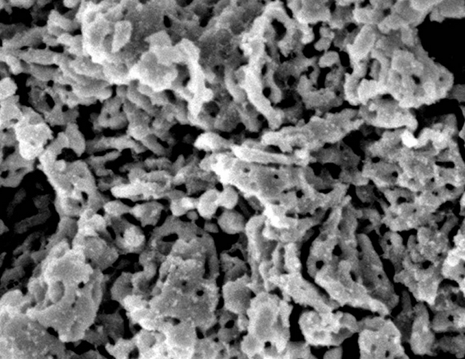 Μια μικροσκοπική εικόνα ουψαλίτη