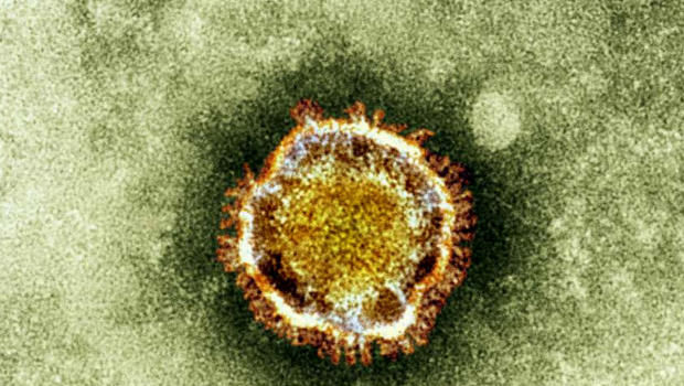 O κοροναϊός MERS (Middle East respiratory syndrome coronavirus)