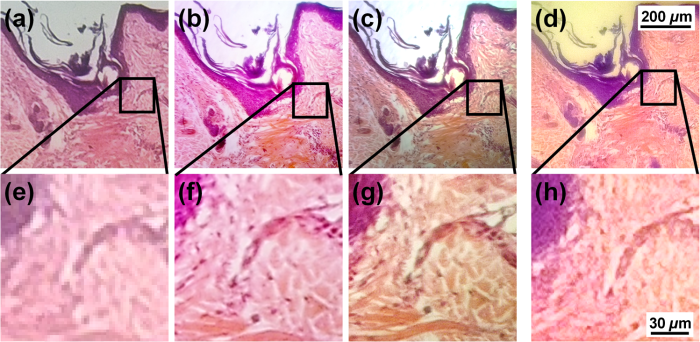 Στις εικόνες a έως c, ανθρώπινα τριχοθυλάκια όπως φαίνονται σε επαγγελματικό μικροσκόπιο Olympus. Στο d, η αντίστοιχη εικόνα με τον νέο πλαστικό φακό (Πηγή: University of Houston)